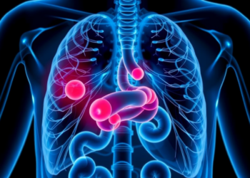 Common Bowel Drug Triggers Rare Pneumonia in Just Seven Days, Doctors Warn