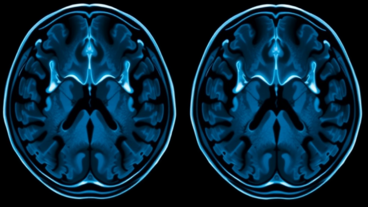 MRI Before Prostate Biopsy Surges Nationwide as New Evidence Reshapes Care
