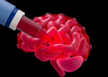 Simple Blood Clot Marker and AI Models Predict Recovery After Brain Bleed