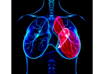 Liposomal Paclitaxel With HER-2 Blockers Shows Strong Real-World Results in Advanced Breast Cancer