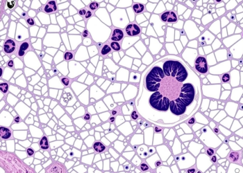 AI Reads Dog Lymph Node Slides with Near-Pathologist Accuracy in Lymphoma Study