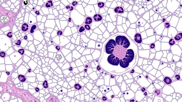 AI Reads Dog Lymph Node Slides with Near-Pathologist Accuracy in Lymphoma Study