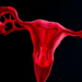 Rare Ovarian Tumor Defies Expectations With Unusual Hormone Receptor Signature