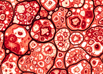 Tumor Slice Cultures Reveal New Pitfalls in Testing AAV Gene Therapy for Glioblastoma