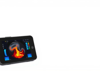 Low-Cost Portable Ultrasound Device Speeds Fracture Healing and Eases Chronic Tendon Pain
