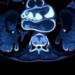 Rare Arterial Injury After Yttrium-90 Radioembolization Reveals Hidden Vascular Risk