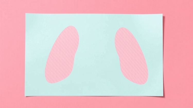 Simple Prompt at Lung Screening Visits Could Close Breast Cancer Screening Gap in High-Risk Women