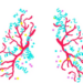 Genomic and Transcriptomic Landscape of Spread Through Air Spaces in Stage 1 Lung Adenocarcinoma