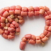 Gut Microbes May Predict Who Keeps Weight Off After Fasting, Study Finds