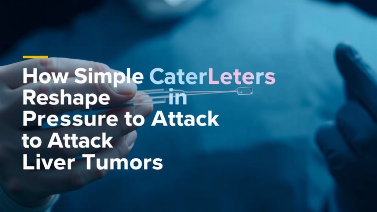 How Simple Catheters Reshape Blood Pressure to Attack Liver Tumors