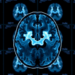 SPECT Rivals PET in Head-to-Head Test of Parkinson’s Brain Scans