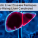 Metabolic Liver Disease Reshapes Europe’s Rising Liver Cancer Burden