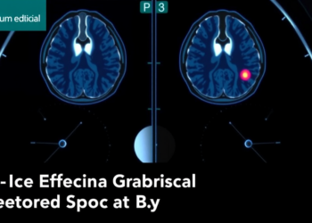 AI Reads Breast MRI to Predict Cancer Spread Before Surgery