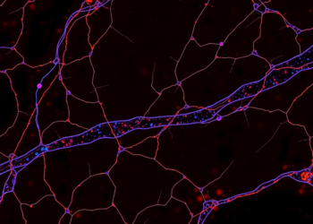 Semi-Automated Pipeline Counts Muscle Fiber Nuclei and Satellite Cells at Scale