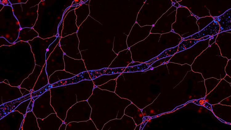 Semi-Automated Pipeline Counts Muscle Fiber Nuclei and Satellite Cells at Scale