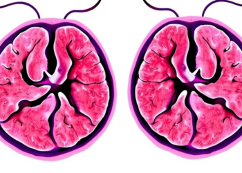 AI Reads Three Layers of Breast Cancer Biology at Once to Sharpen Subtype Diagnosis
