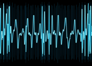 EEG Bursts Reveal Distinct Brain Rhythms Behind Parkinson’s and Freezing of Gait