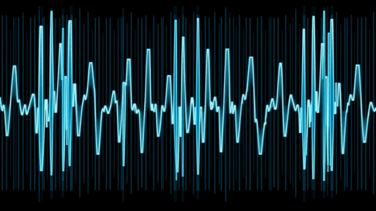 EEG Bursts Reveal Distinct Brain Rhythms Behind Parkinson’s and Freezing of Gait
