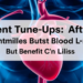 Stent Tune-Ups After Heart Procedures Boost Blood Flow, But Benefit Has Limits