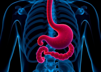 When Crohn’s Stomas Become Permanent: 40-Year Study Tracks Long-Term Outcomes in 422 Patients