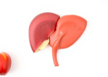 Fatty Liver Disease in Children Raises Cardiovascular Risks With No Approved Treatment Yet