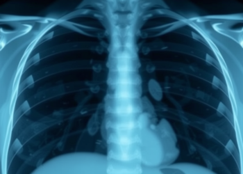 AI Reads Chest X-Rays With Near-Perfect Accuracy, Then Stumbles in the Real World