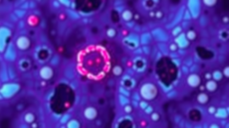AI Counts Tumor Buds in Colon Cancer Slides, Offering a New Prognostic Edge
