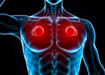 Muscle Fat, Not Muscle Mass, May Signal Early Setbacks in Radioactive Tumor Therapy
