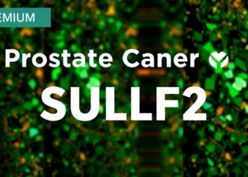 Prostate Cancer Study on SULF2 Retracted Over Overlapping Blot Images