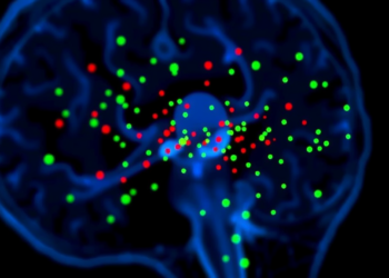 Laser Speckle Imaging Offers an Objective Window Into Pain and Nociception
