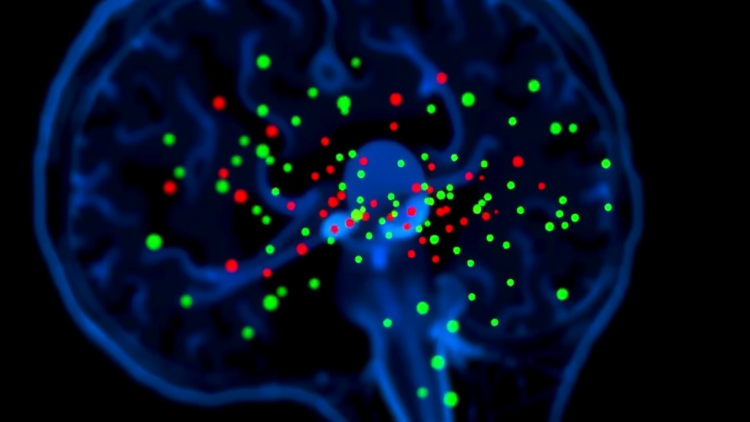 Laser Speckle Imaging Offers an Objective Window Into Pain and Nociception