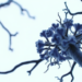 When Tuberculosis and Aspergillus Collide: A Rare Case of Runaway Blood Calcium