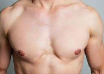 Insurance Denials for Chest Masculinization Surgery Fell Sharply Over a Decade of Policy Change