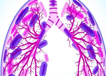 Rare ALK Fusion Lung Cancer Shows Durable Response to First-Line Lorlatinib