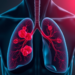 Blood Fats May Fuel Lung Cancer Spread Through a Hidden Metabolic Switch