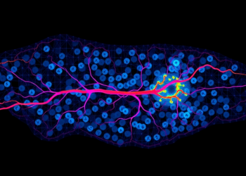 Single-Cell Map Reveals Vascular Barrier That Predicts BCG Failure in Bladder Cancer
