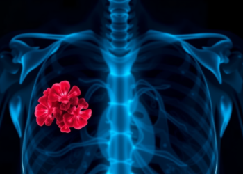 Rare Breast Cancer That Hides as a Benign Lump Diagnosed in Postmenopausal Woman