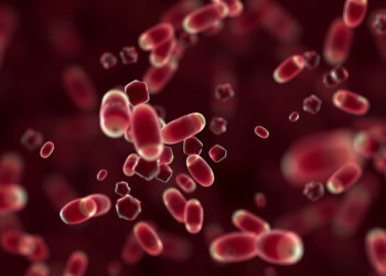 Blood Test Reading Tumor Methylation Patterns Outperforms CEA in Real-World Colorectal Cancer Detection