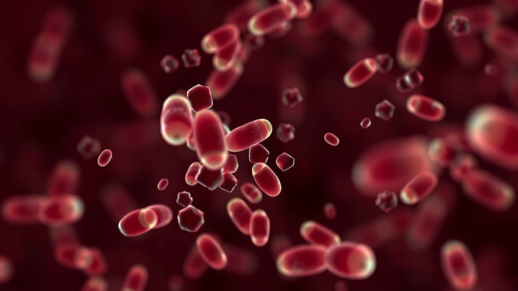 Blood Test Reading Tumor Methylation Patterns Outperforms CEA in Real-World Colorectal Cancer Detection