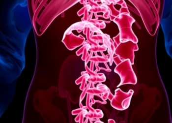 Rare Abdominal Cancer With PLAG1 Gene Rearrangement Emerges After Fibroid Surgery