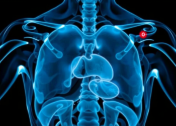 AI Maps Every Torso Muscle in CT Scans, With a Built-In Lie Detector
