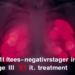 Small Triple-Negative Breast Tumors Blur the Line Between Stage I and Stage II Treatment