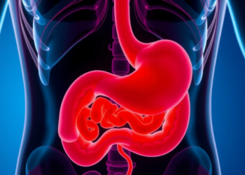 When Chemotherapy Triggers Bleeding: A Warning Sign in Gut Lymphoma