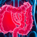 Cell-Disguised Nanoparticles Show Promise for Targeted Colon Cancer Therapy