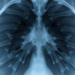 Zero-Dimensional Semiconductor Design Eliminates Defects for Sharper X-ray Imaging