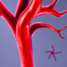 Inside the Artery: Landmark Trials Redefine When Imaging Improves Stent Outcomes