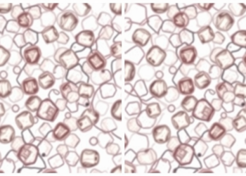 AI Learns to Untangle Overlapping Cervical Cells in Pap Smears