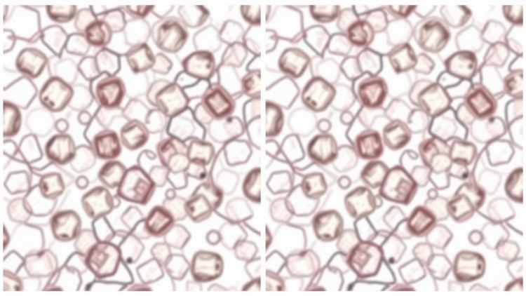 AI Learns to Untangle Overlapping Cervical Cells in Pap Smears