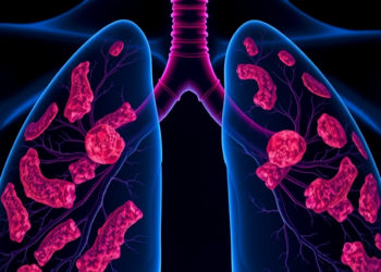 Rare POLE P286R-Mutated Lung Cancer Shows Dramatic Response to Immunotherapy