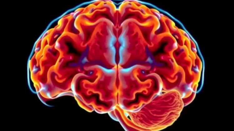 AI Predicts Brain Shift During Epilepsy Surgery Using Only Pre-Operative Scans